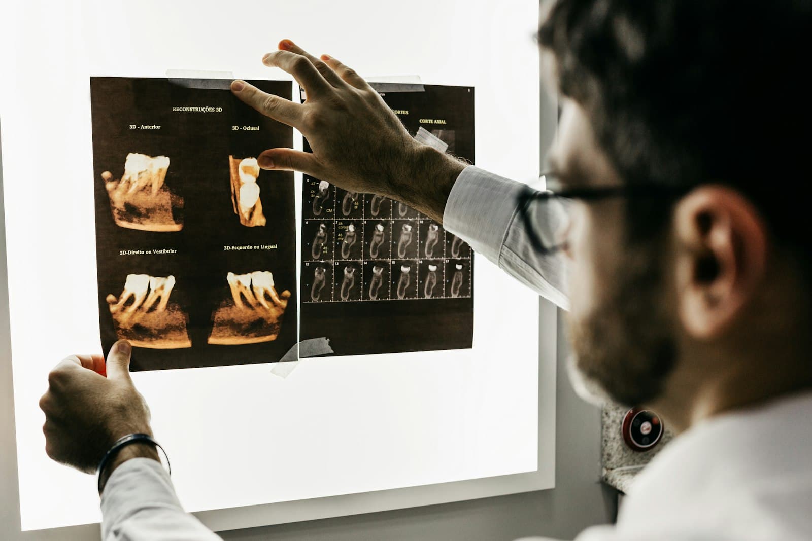 Tandarts bekijkt röntgenfoto's van een gebit